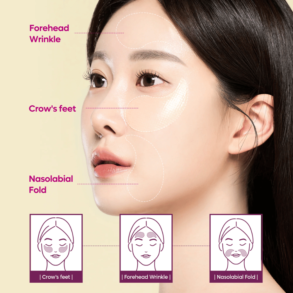 Modelo con parches para ojos colocados en las patas de gallo, frente y líneas nasolabiales que muestra cómo Dr. Melaxin Cemenrete Calcium Volume Eye Patch se puede usar para arrugas y pérdida de volumen.