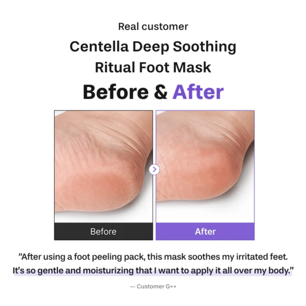 6. Baren Centella Deep Soothing Ritual Foot Mask – imagen de antes y después que muestra un talón más suave y más hidratado tras el uso