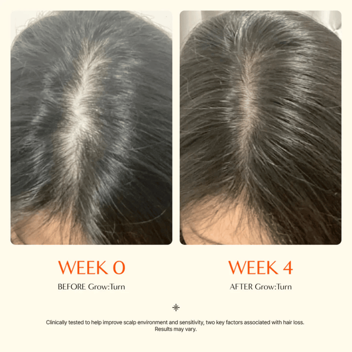 Primer plano del cuero cabelludo antes y después de 4 semanas: una raya del cabello más definida que se ve más densa tras el tratamiento.