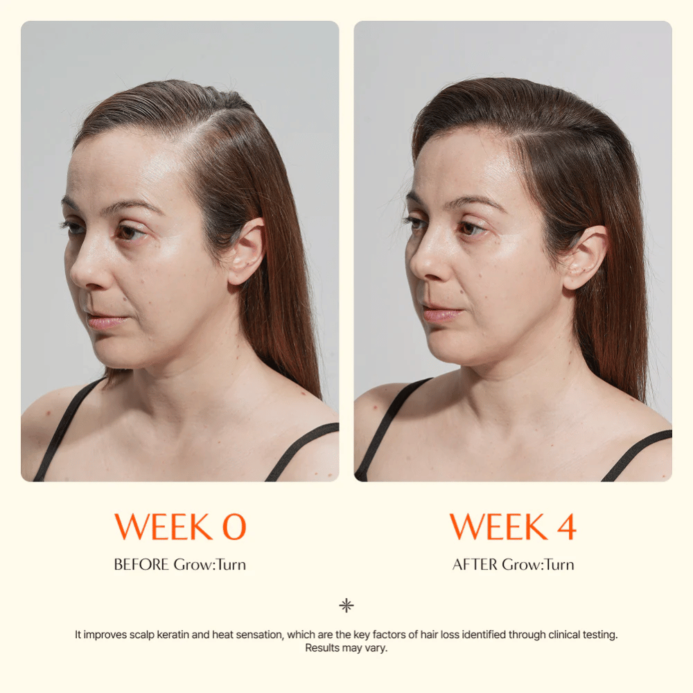 Imagen de antes y después de una mujer (semana 0 vs. semana 4) que muestra una mejor calidad del cabello y una sensación de mayor volumen tras el uso.