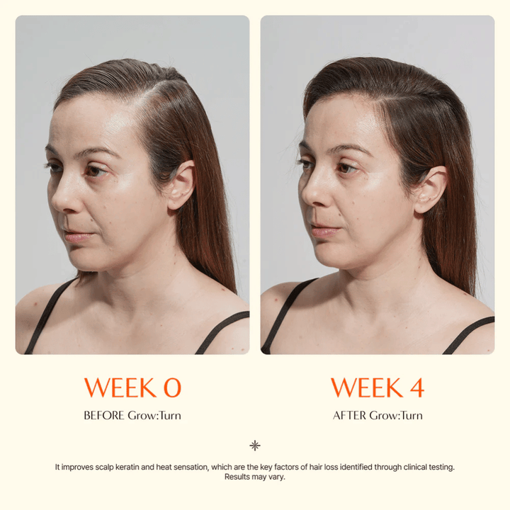 Imagen de antes y después de una mujer (semana 0 vs. semana 4) que muestra una mejor calidad del cabello y una sensación de mayor volumen tras el uso.