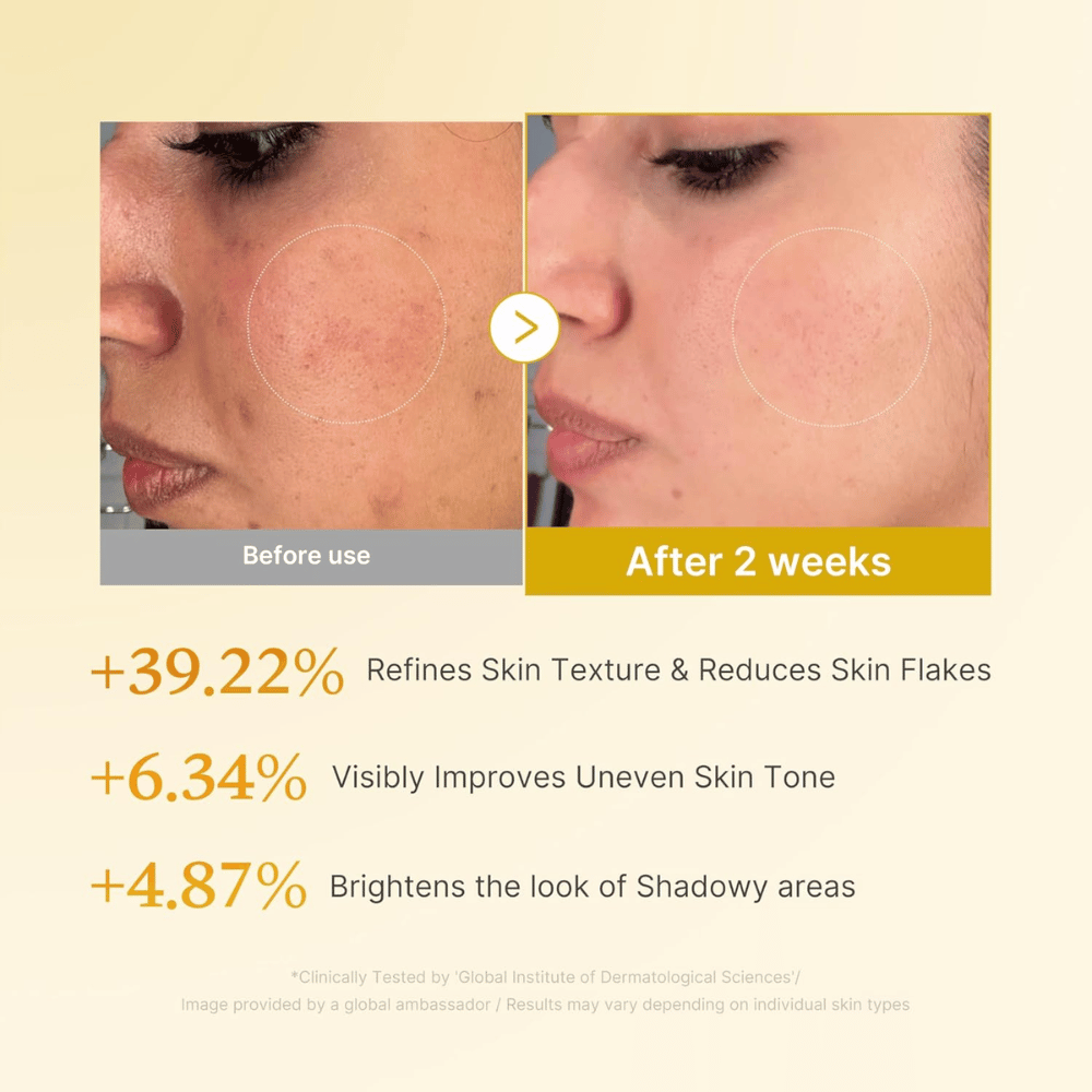 Imagen de antes y después para Medicube Kojic Acid Turmeric Resurfacing Toner que muestra una textura de la piel mejorada, un tono de piel más uniforme y reducción de escamas secas tras dos semanas de uso.