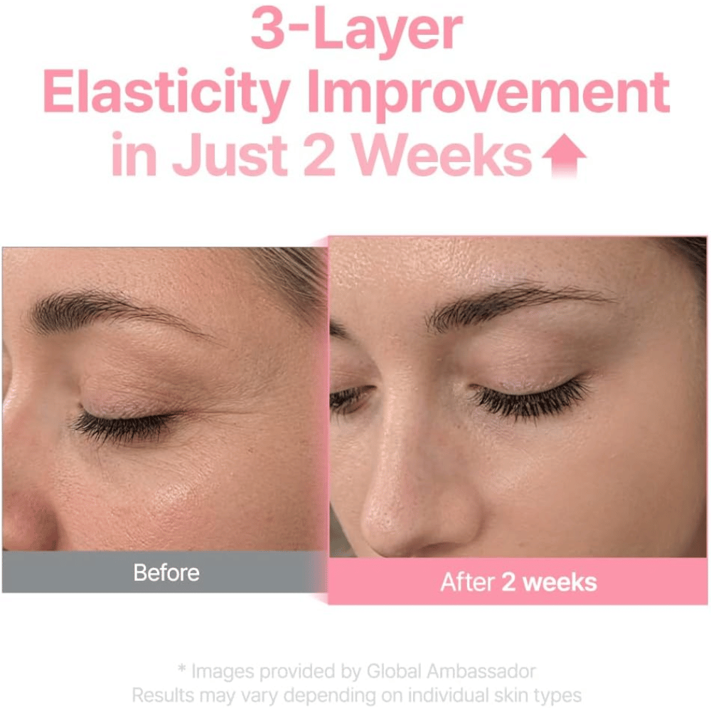 Imagen de antes y después de Purito Multi PDRN Collagen EGF Serum que muestra una mejor elasticidad de la piel después de dos semanas.