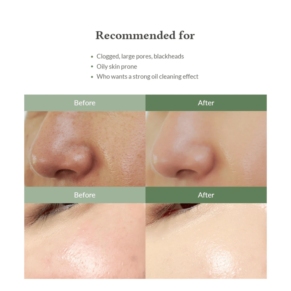 Dr. Althea Premium Quick Step Sebum Cleanser – limpieza facial que ayuda a reducir los puntos negros, limpiar los poros en profundidad y proporcionar una textura de piel más uniforme.