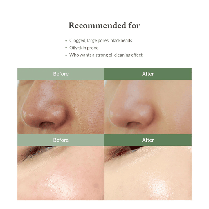 Dr. Althea Premium Quick Step Sebum Cleanser – limpieza facial que ayuda a reducir los puntos negros, limpiar los poros en profundidad y proporcionar una textura de piel más uniforme.